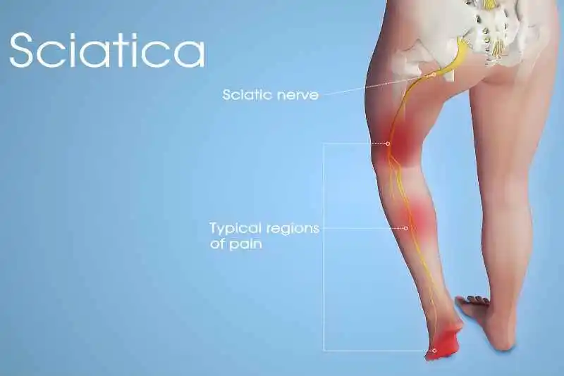 Sciatica Specialist Doctor in Pune at Human Mechanic Clinic