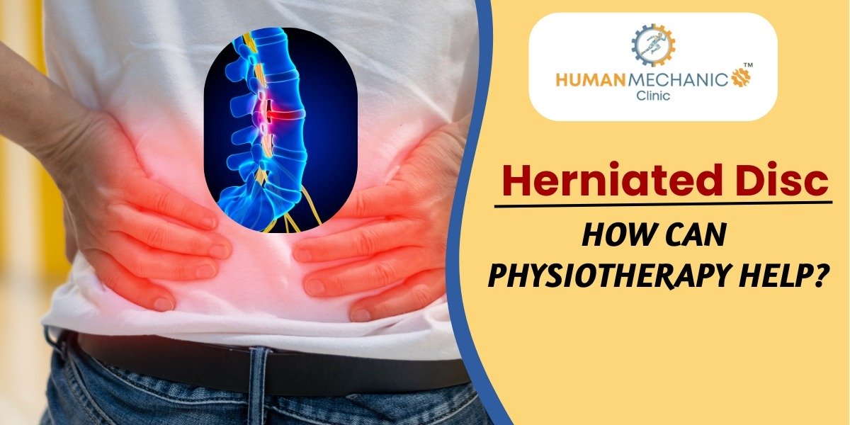 How Can Physiotherapy Help For Herniated Disc?