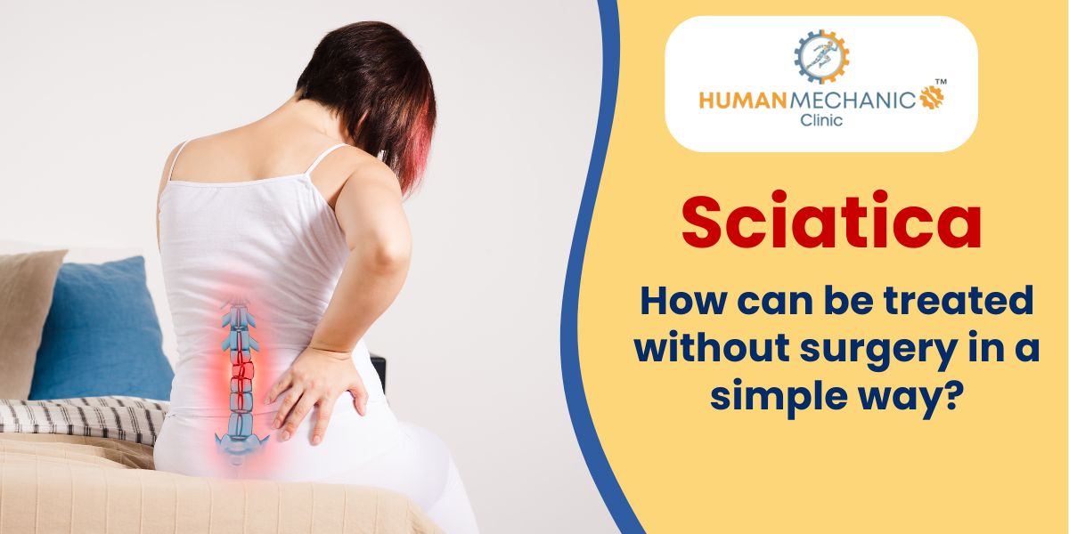 Sciatica - How it can be managed without surgery