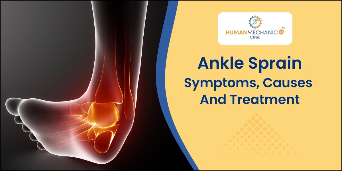 Ankle Sprain Treatment