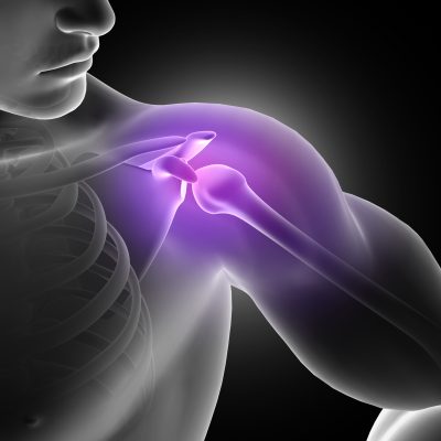 Arthritis Specialist In Pune