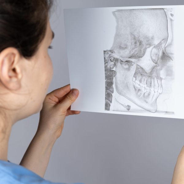 The doctor holds a CT scan of a patient with temporomandibular joint dysfunction and malocclusion